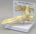 Ankle and Foot Model with Plantar Fasciitis